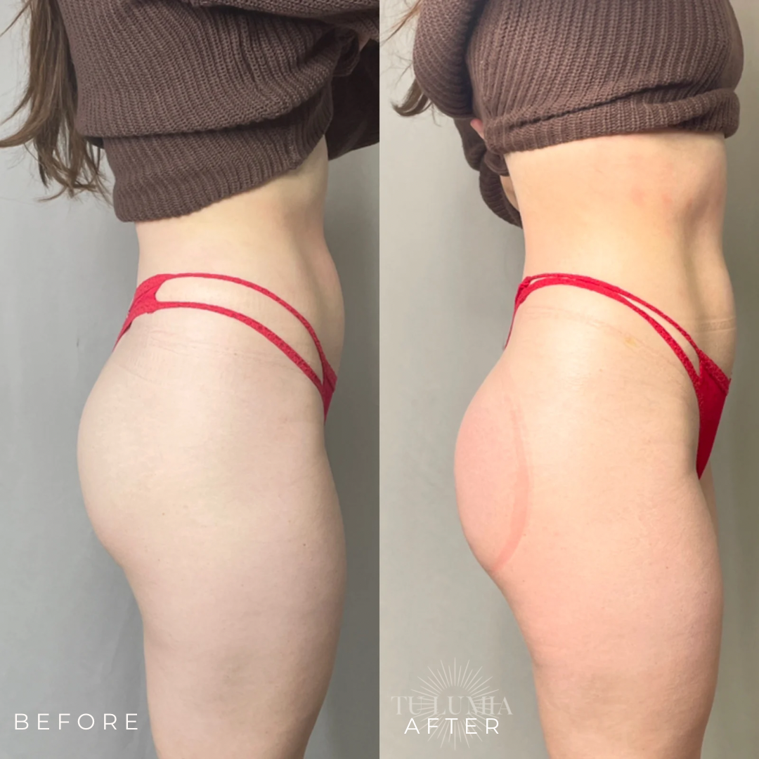 BOOTY SCULPT | 1 SESSION