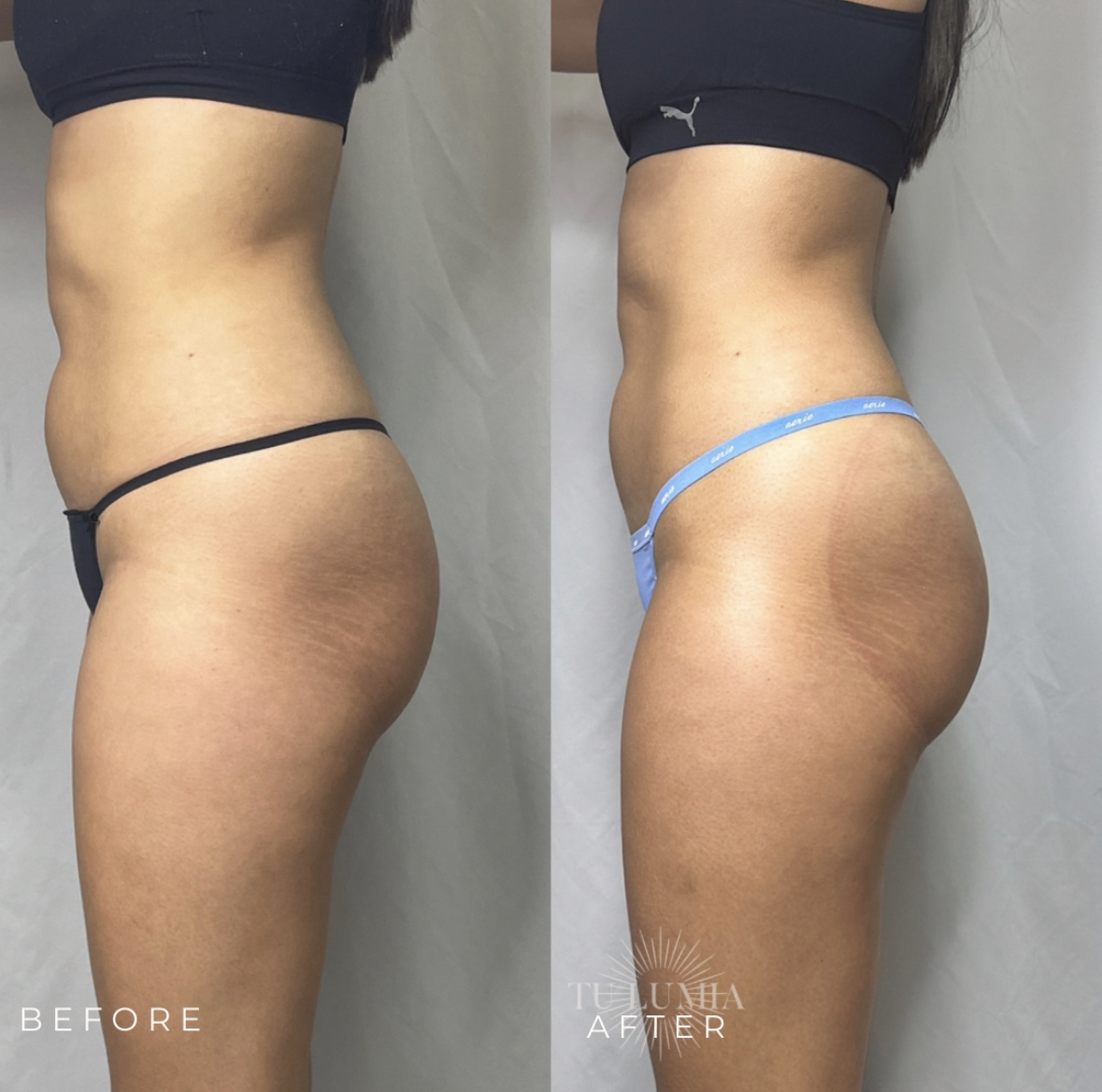 BOOTY SCULPT | 4 SESSIONS