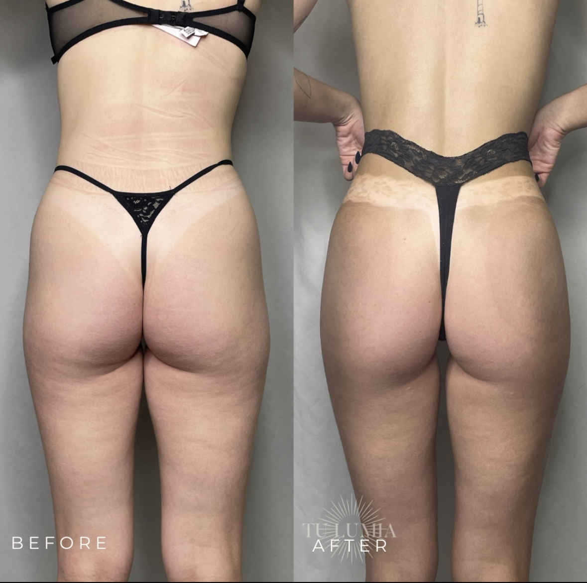 BOOTY SCULPT | 4 SESSIONS