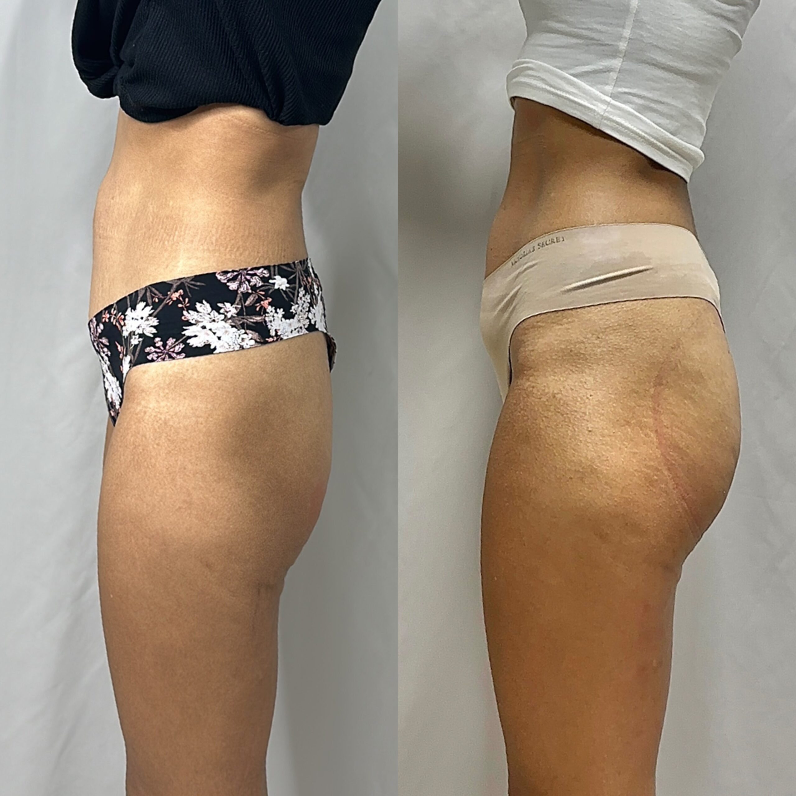 BOOTY SCULPT | 9 SESSIONS