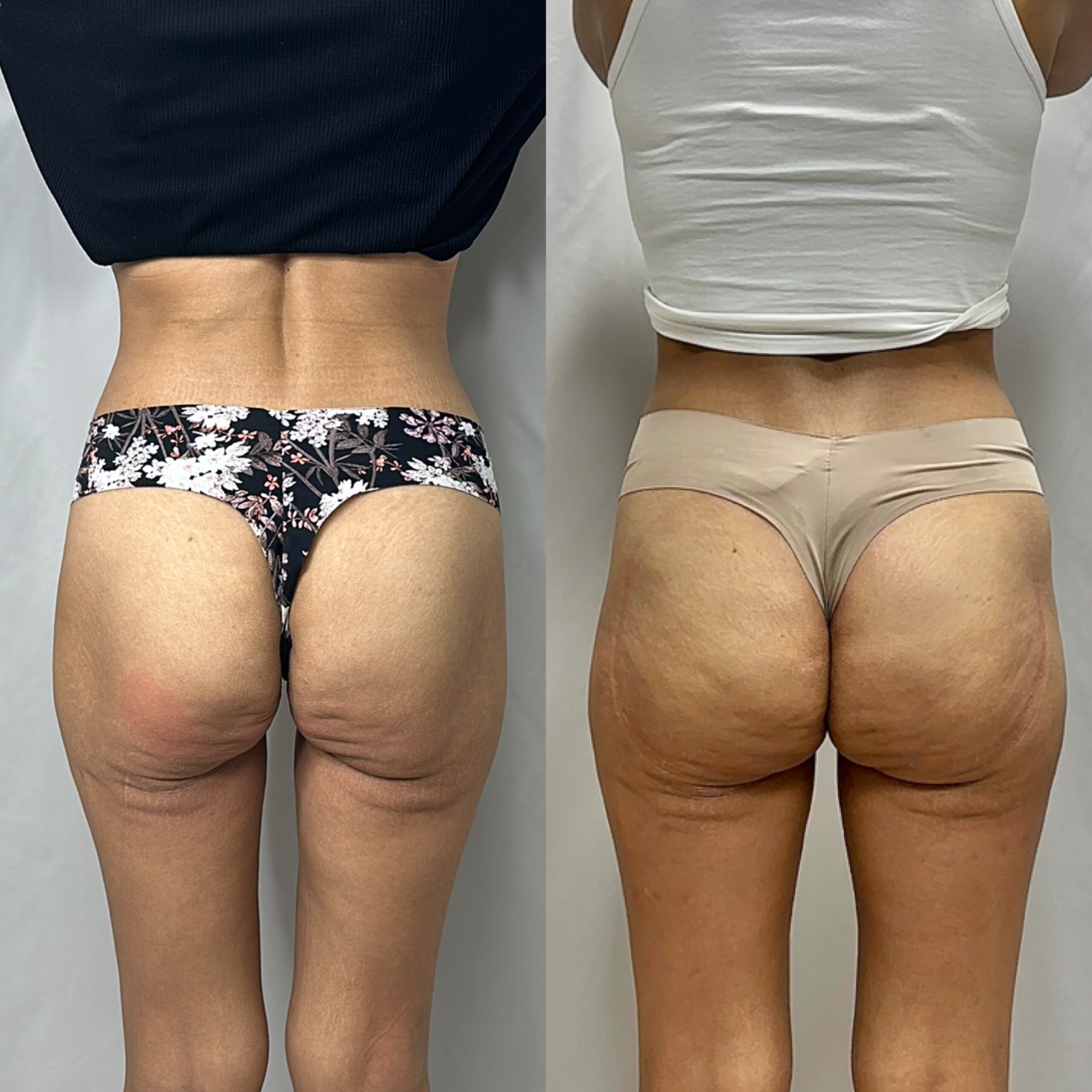 BOOTY SCULPT | 9 SESSIONS